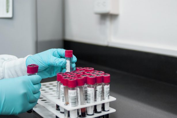 Profissional usando luvas manuseia tubos de ensaio em um laboratório médico.
